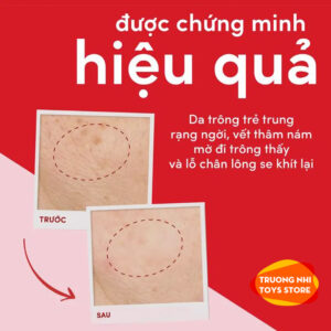 POND'S Kem dưỡng da chống lão hóa ban ngày/đêm 50g